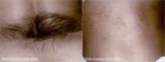 arm2 ba