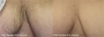 chest ba